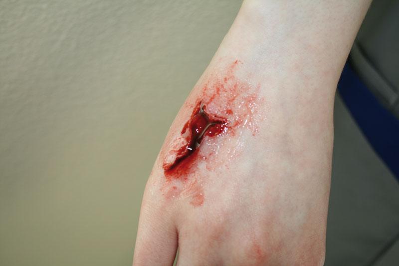 EZ Wounds – Wundensimulation Basic, WS01 - Notemed Medizintechnik 