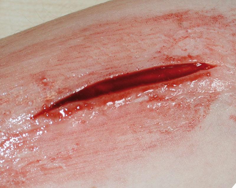EZ Wounds – Wundensimulation für Simulationspatienten, WS03 - Notemed Medizintechnik 