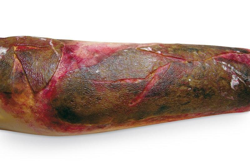 Simulierte Verbrennungen, R11015 - Notemed Medizintechnik 