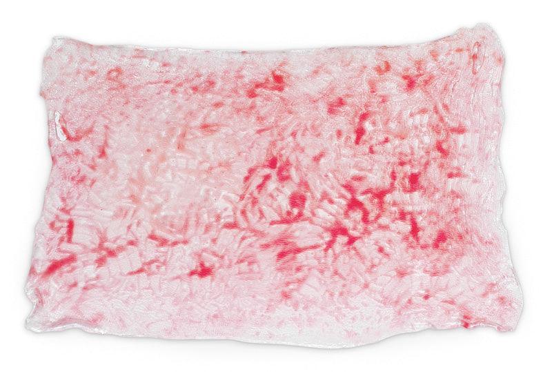 Simulierte Verbrennungen 2. Grades (oberflächlich), R11015B - Notemed Medizintechnik 
