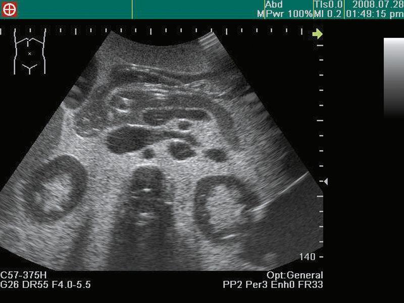 Ultraschall-Übungsmodell Anatomie / Pathologie, R16560 - Notemed Medizintechnik 