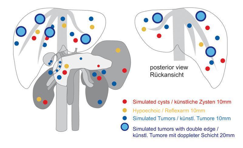 Ultraschall-Übungsmodell Anatomie / Pathologie, R16560 - Notemed Medizintechnik 