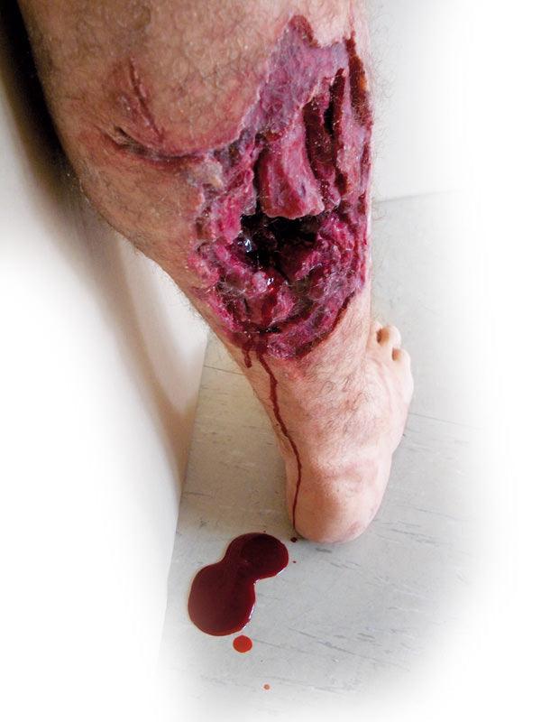 Notfall-Unterschenkel, R50010 - Notemed Medizintechnik 