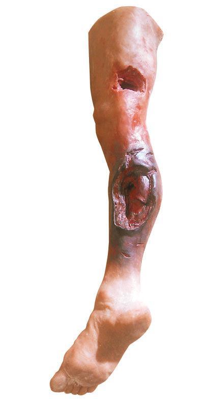 Notfallbein, R50020 - Notemed Medizintechnik 